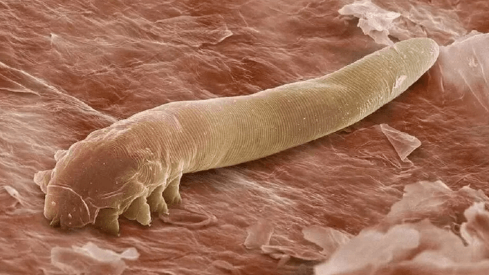 Parasiten im menschlichen Körper