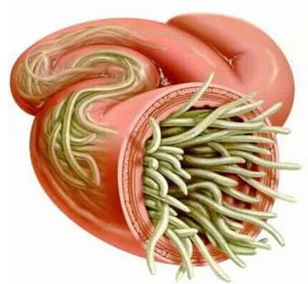 Symptome und Behandlung menschlicher Parasiten