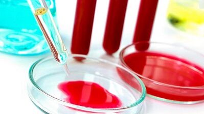 Blutanalyse für Parasiten